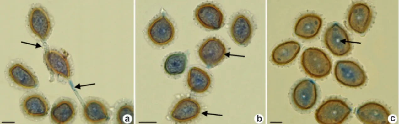 Figura 1 – a-c. Prospodium bicolor – a. aeciósporos associados ao pedicelo (seta); b. parede externa com crista  (seta); c