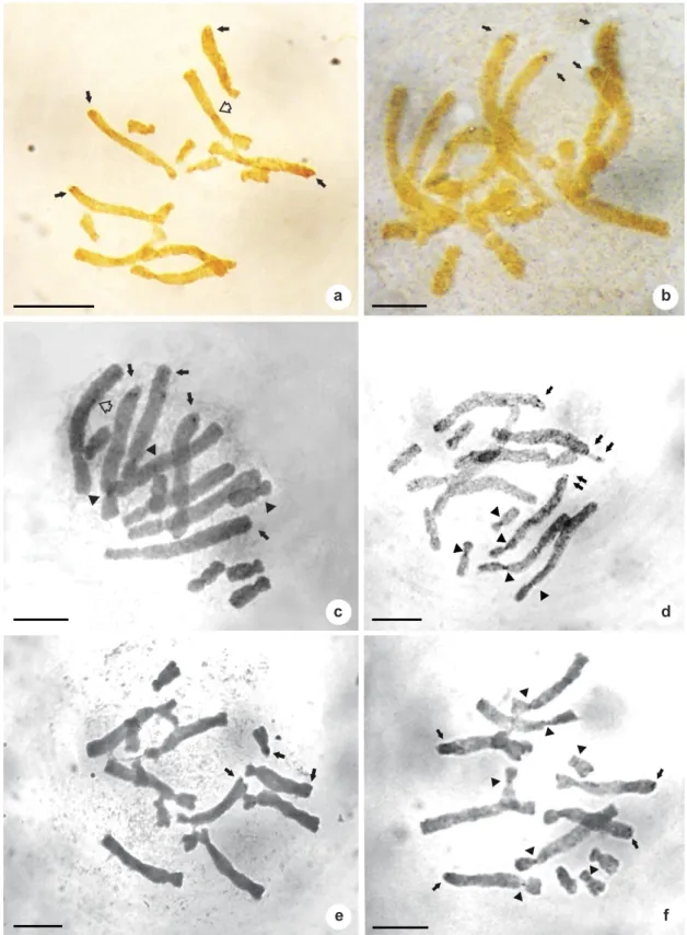 Figure 1 – Silver-stained somatic metaphases of Aloe: four AgNORs in (a) Aloe immaculata, (b) A