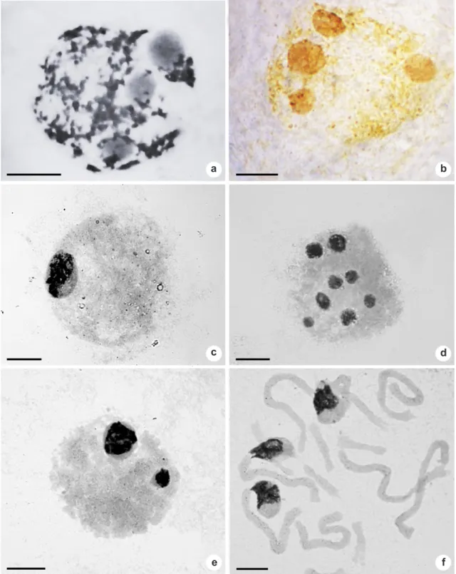 Figure 3 – Silver-stained interphase nuclei of Aloe: interphase nucleus with three Ag+ nucleoli in (a) Aloe immaculata; 