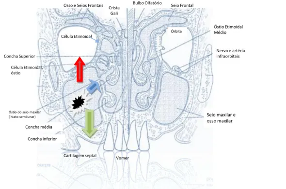 Figura 1. Relação do seio maxilar com as demais estruturas anatômicas do esqueleto  craniofacial