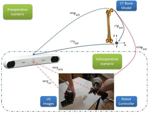 Figure 1.3: Overview of the hardware setup and frames transformations of HipRob navigation system.