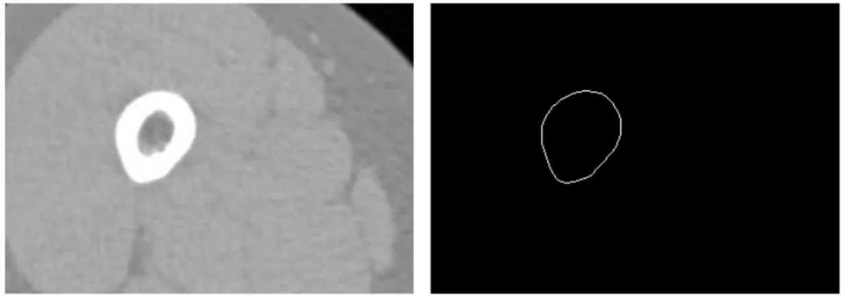 Figure 3.11: Segmentation result of CT images in the central part of the bone.