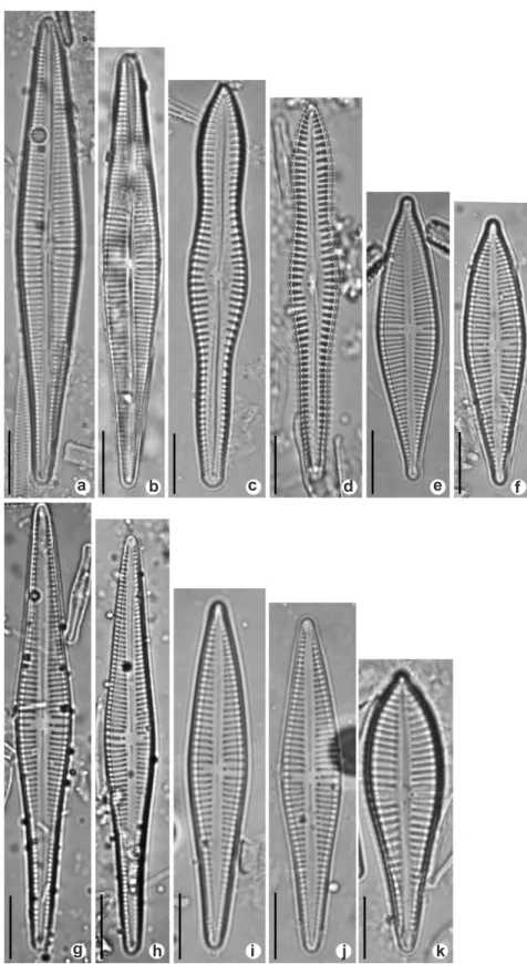Figura 2 – Imagens em microscopia óptica – a,b. G. archaevibrio; c,d. G. butantanum; e,f