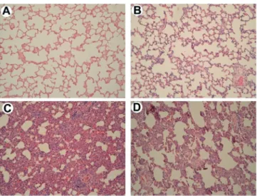 FIGURE 2  -Effects of Hev b 13 on cytokine production in lung  tissue from sepsis rats: after 10 h of subcutaneous  treatment with 0.5 mg/kg Hev 13, the animals were  euthanized, lung tissue samples were collected,  including control, for cytokine dosage w