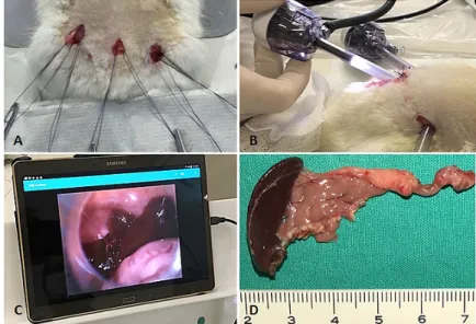 Figure 3 - General aspects of laparoscopic technique. A. The three purse-string suture done
