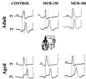 Figure  1  -  Electrophysiological  recordings  (slow  potential changes, P) of CSD in rats supplemented  with murici extract