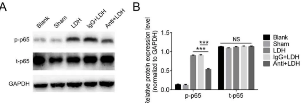 Figure 6  -  CX3XL1  regulates  LDH-induced  neuropathic  pain  through  NF-κB  pathway