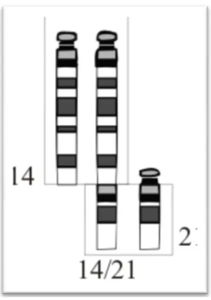 Figura 2 - Translocação dos cromossomas 21 e 14 