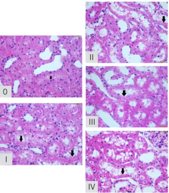 Figure 1 - Acute tubular necrosis degrees by  Jablonski.  0,  absence  of  abnormalities;  I, mitosis  and necrosis in individual cells; II, necrosis of the  cells adjacent to the proximal convoluted tubules,  preserving the neighboring tubules; III, necro