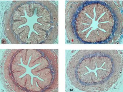 Figure 1 - Light-microscopic images of the ureters in the groups. Control (1a), Group 1 (1b), Group 2 (1c),  Group 8 ( 1d ), Epithelium (E), lamina propria (Lp), muscle layer (M)