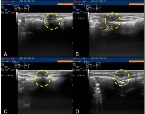 Figure 2  - Transversal ultrasonographic image of the monofilament polyamide surgical mesh over the incisional  defect in the abdominal ventral muscle of rabbits in the immediate ( A ), 40-day ( B ), 120-day ( C ), and 180-day  postsurgical period ( D )