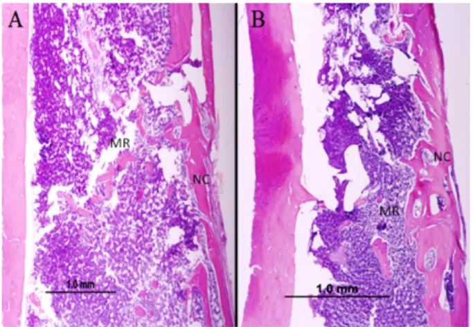 Figure 1  - Microscopic appearance of the surgical  cavity of the Cigarette Clot Group (CCG), stained in  HE, x4 objective
