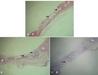 Figure 2 - Evaluation within 8 weeks (A-C).  A . Group  I (calcium phosphate cement): deposition of new  bone around the place leaved by the particles of the  material used during the decalcification process