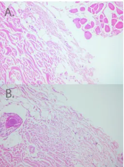 Figure 8   -  Evaluation  of  histological  images  for  capillary formations.  A . Sildenafil group