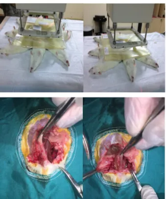 Figure 1 -   Application  of  radiation  ( above )  and  dissection of rectums ( below ) after the sacrification  of rats.