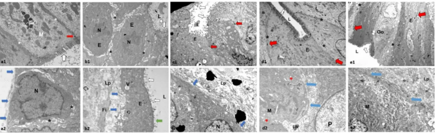 Figure 3 -  Electron micrographs of rectum sections from experimental rat model of radiation proctitis