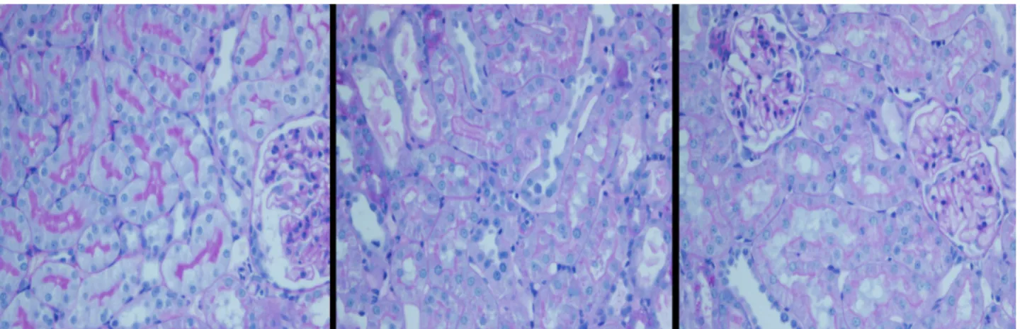 Figure 3  - Ozone oxidative preconditioning attenuated the injury of brush border of proximal renal tubular  after kidney transplantation