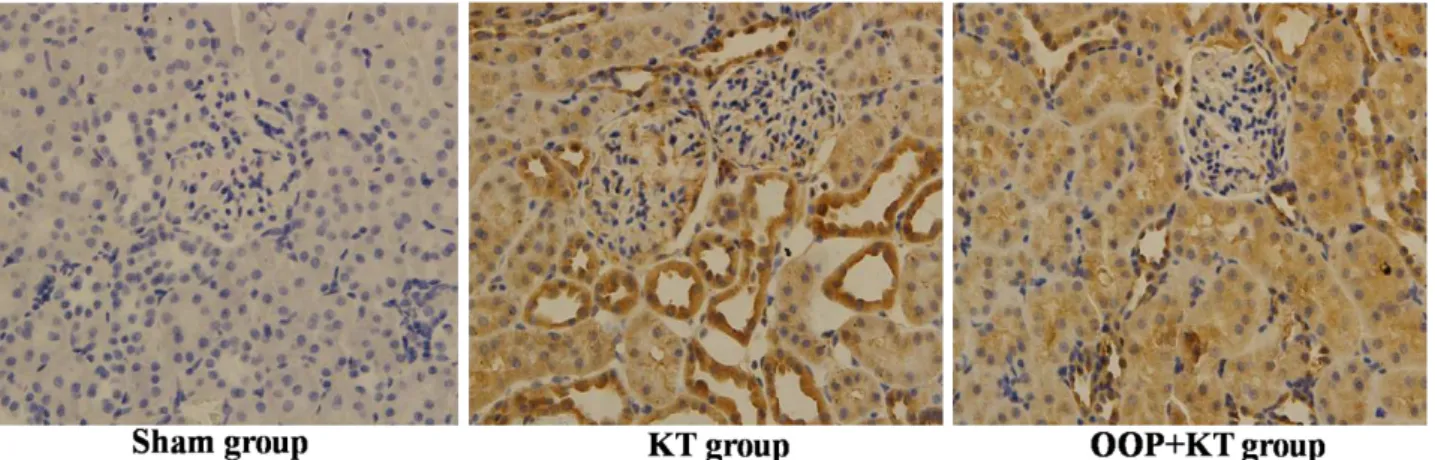Figure 6  - Ozone oxidative preconditioning restrained the expression level of NF- κBp65 in renal tissue after   kidney  transplantation  according  to  the  representive  micrographs  of  immunohistochemistry  (×400)
