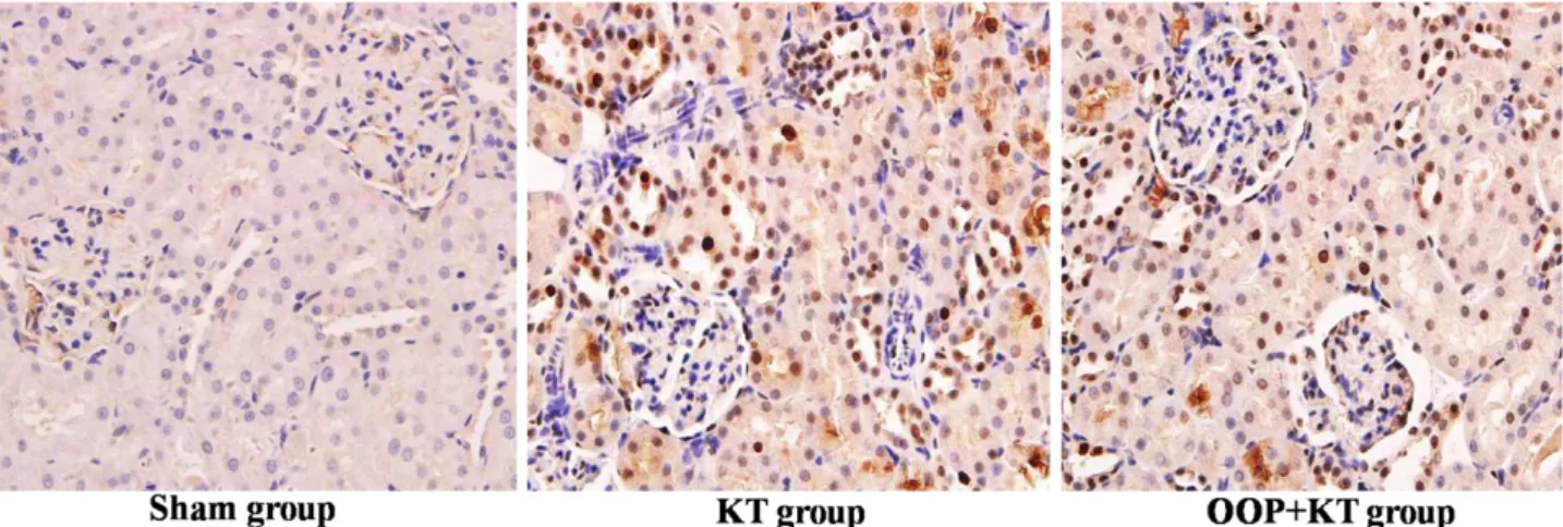 Figure 7 -  Ozone oxidative preconditioning suppressed the expression of HMGB1 in renal tissue after  kidney  transplantation according to the representive micrographs  of immunohistochemistry (×400)