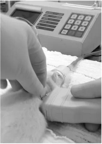 Figure 1 -  Ultrasound used to guide thoracentesis.