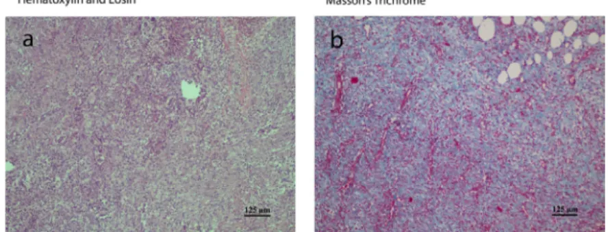 Figure 3 -   Microscopic  appearance  of  anastomosis  site in  the  ( a )  control  group  and  ( b )  NCHA gel  group