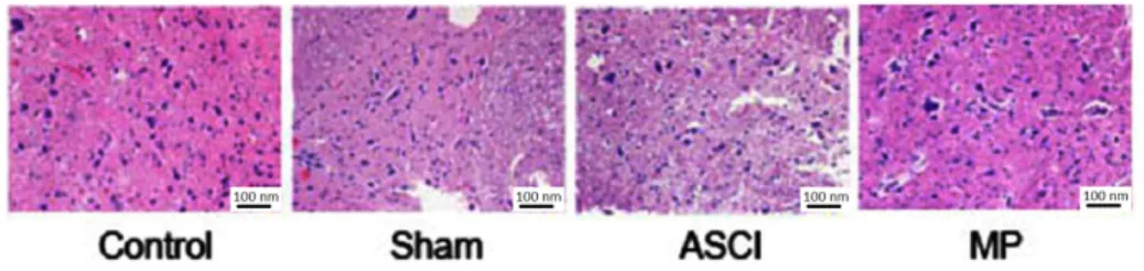 Figure 2 -  Impacts of MP on post-ASCI spinal cord morphologies (HE ×200).