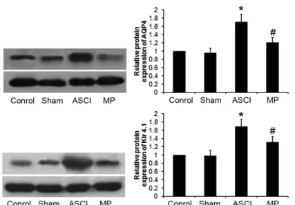 Figure 3 -  Impacts of MP on expressions of AQP4 and Kir4.1 in post-ASCI medullispinal tissues ( x ±SD, n = 10)