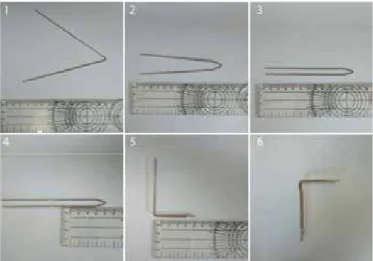 Figure 2. Examples of Kirschner (K)-wires inserted into pre-estab- pre-estab-lished holes.