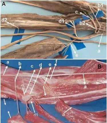 Figure 2. A. (a) median nerve; (b1) first branch from the pronator teres; 