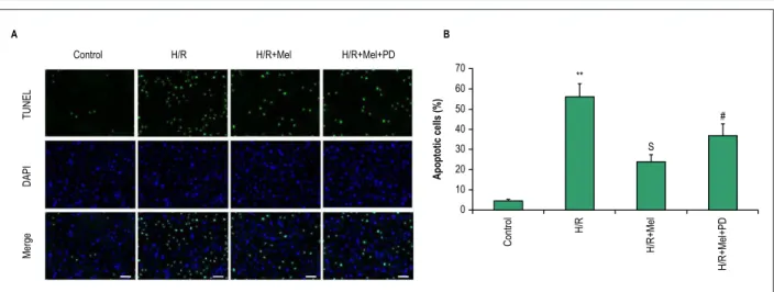 Figure 2 – Melatonin prevents H9C2 cells apoptosis against H/R via ERK1 in vitro. Apoptosis was assessed by fluorescence TUNEL
