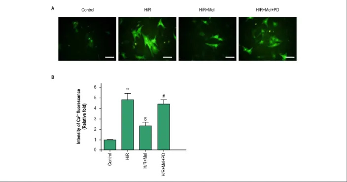 Figure 4 – Melatonin reduces Ca 2+  overload in H9C2 cells against H/R via ERK1 in vitro