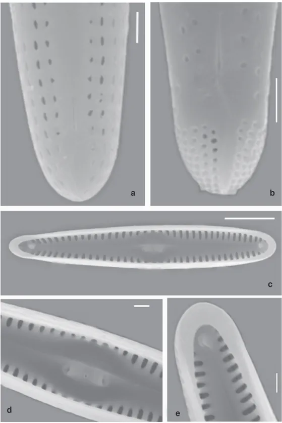 Figura 6 – Gomphonema tenuissimum (MEV) – a. vista valvar externa mostrando as estrias unisseriadas; b