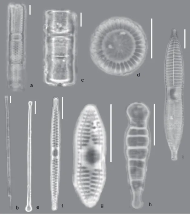 Figura 2 – a. Aulacoseira granulata; b. A. granulata var. angustissima; c. Melosira varians; d