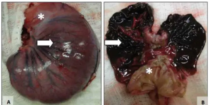 Figure 1 –  Macroscopic  aspect  of  the  closed  and  opened  stomach  of  the  same  rabbit  after  6h  of  gastric ischemia
