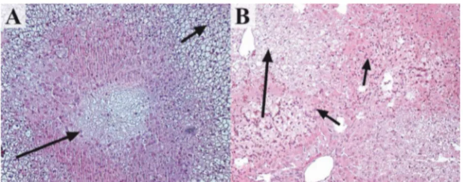 Figure 4  – Microscopic aspect of livers removed after gastric ischemia. A. Center lobule necrosis ( big arrow )  and vacuolar hydropic degeneration ( small arrow ) in a rabbit liver from group 1 (HE, x100)