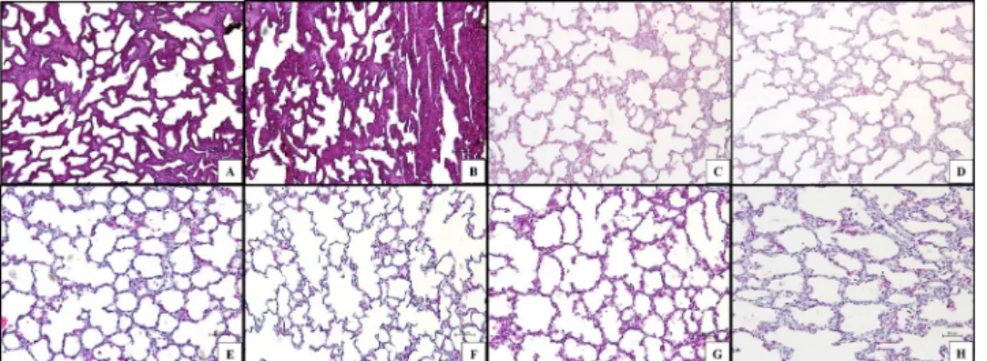 Figure 6 –  Masson Trichrome staining of lung tissue sections.  A)  Group E25.  B ) Group E25V