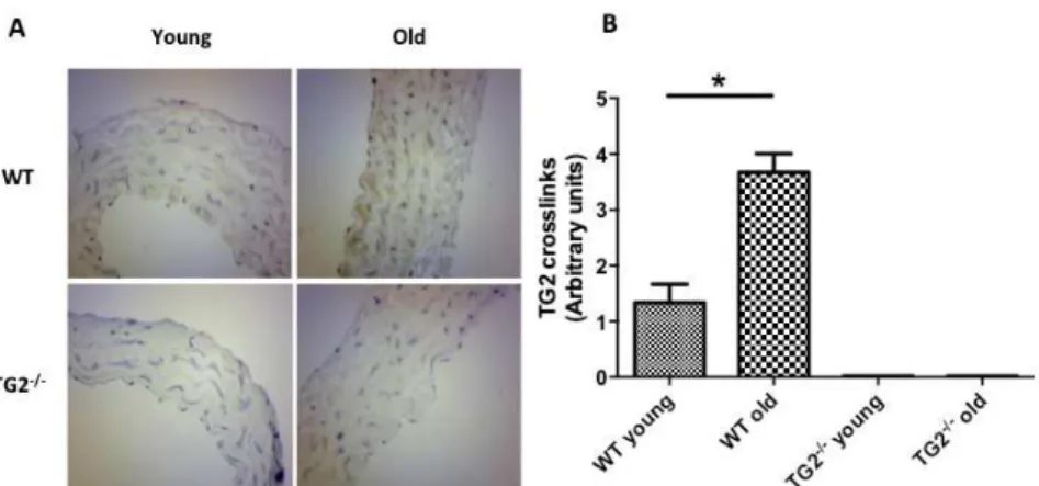 Figure 3 - A . Immunohistochemical analysis of TG2 presence (immune staining with anti-TG2 monoclonal  antibody, x400) in wildtype young and old groups compared to TG2 -/-  young and old groups