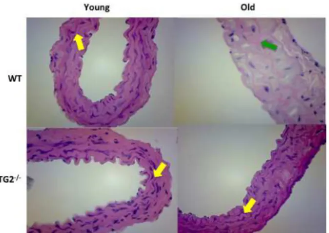 Figure 4 -  Optical  microscopy  (H&amp;E,  x400)  of  aortics rings from wildtype old and young groups  compared to TG2 -/-  old and young groups