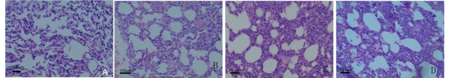 Figure 1  - Histopathological changes in each group (HE ×100).  A : Group A;  B : Group B;  C : Group C;  D : Group D.