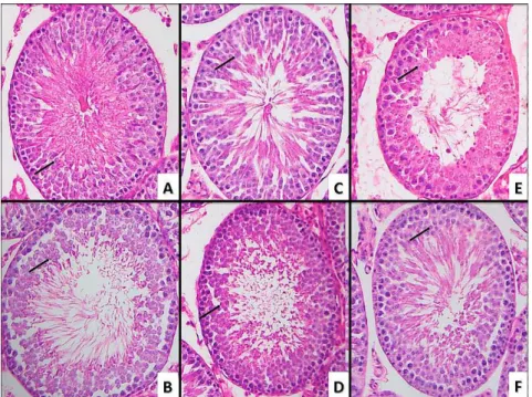 Figure 2 –  Microscopic  sample  of  testicular  parenchyma  of  a  rat  from  the  ( A )  3-months-old  group,  ( B )  6-months-old group, ( C ) 9-months-old group, ( D ) 12-months-group, ( E ) 18-months-old group, ( F )  24-months-old group