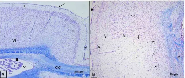 Figure 1 -  Photomicrographs of the dorsolateral region of the frontal cortex of group C ( A  - mouse 3) with  the molecular (I) and fusiform (VI) molecules