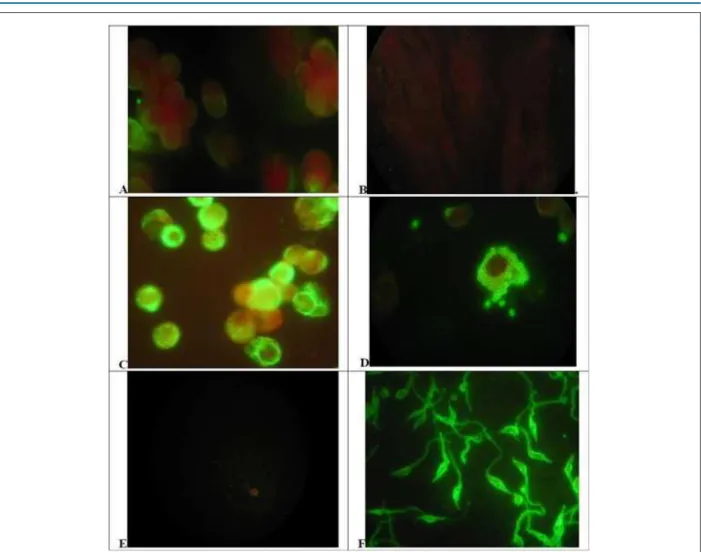 Figure 1 – Distribution of Vimentin or Trypanosoma cruzi antigen on control or infected cells and parasites