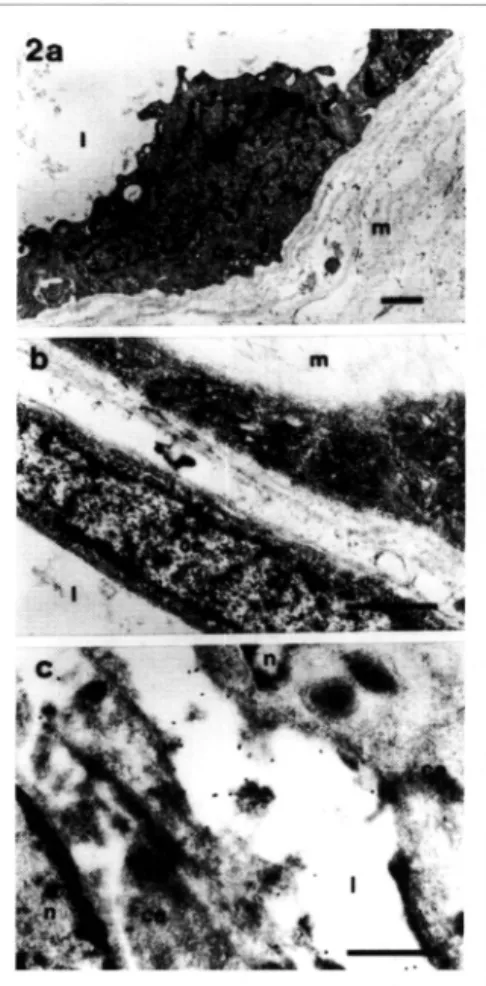 Figura 3 - lnmunofluorescencia indirecta con  FITC, en secciones semifinas por crioultramicrotomía, para  los receptores/3 1  (Fig 3a, 3b) , LN (Fig