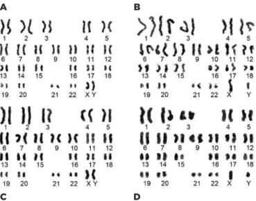 Figure 5. Karyotype analysis. (A) HPF2-derived iPSCs from the CTS sys- sys-tem; (B) HTF1-derived iPSCs from the CTS syssys-tem; (C) HPF2-derived  iPSCs from the conventional system; (D) HTF1-derived iPSCs from the  conventional system.