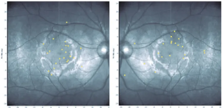 Figure 1. Fixation positions determined by fundus-controlled microperi- microperi-metry for right and left eyes