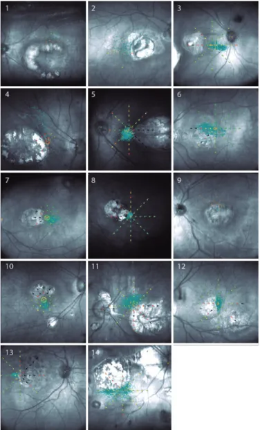 Figure 3. Fixation patterns in the dominant eyes of 14 patients. Age and  reading speed are shown for each patient