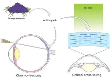 Figure 3. Anthocyanin as a pigment for chromovitrectomy and corneal  cross-linking (Dr