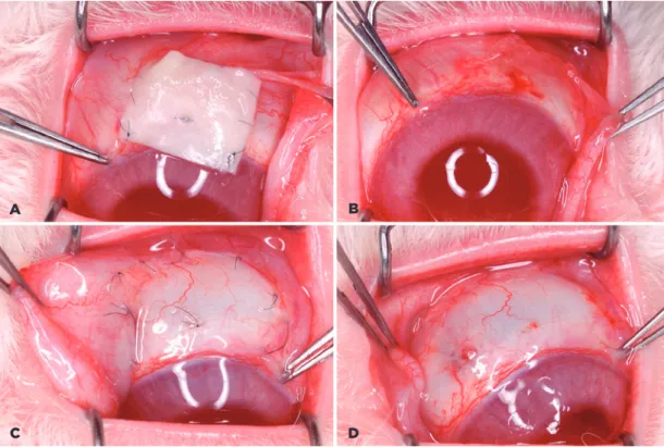 Figure 1. A latex biomembrane and conjunctival autograft at 14 days postoperatively. A) Latex biomembrane before  removal