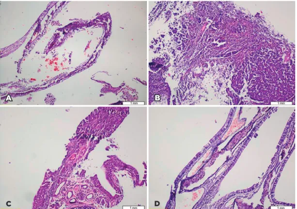 Figure 1. Some of the nasal mucosal alterations observed during histopathological evaluation in the rhinitis medicomen- medicomen-tosa rat model