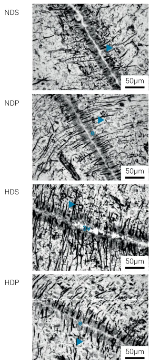 Figure 1. Weight gain (in grams) in 21 days. Groups comprise  the NDS (normocaloric diet + saline), NDP (normocaloric diet  + propentofylline), HDS (hypercaloric diet + saline) and HDP  (hypercaloric diet + propentofylline)